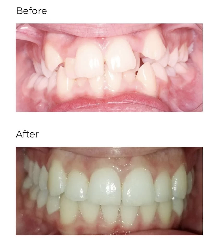 Calismile Orthodontics Picture 6