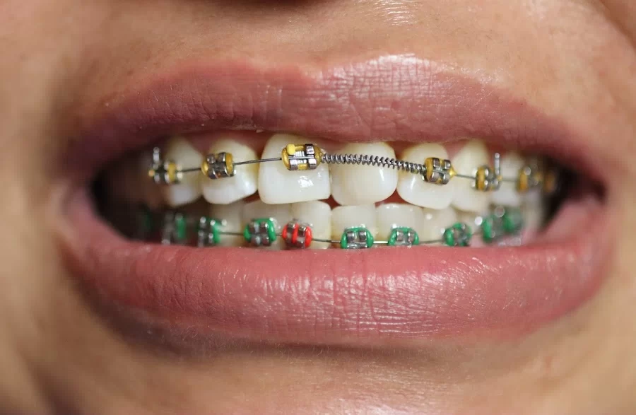 Heart Dental Picture 5