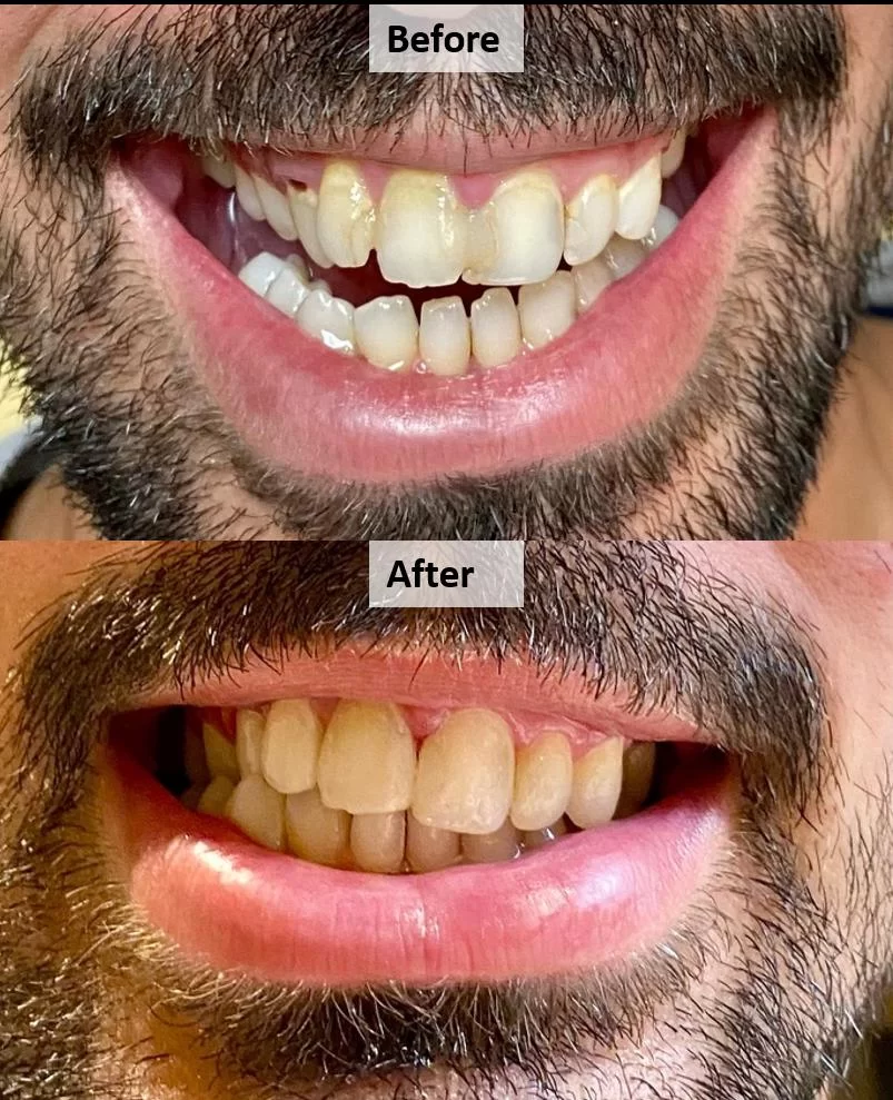 Heart Dental Picture 10