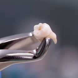 Madison Family Dental Associates Picture 2