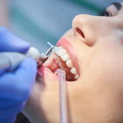 Madison Family Dental Associates Picture 3