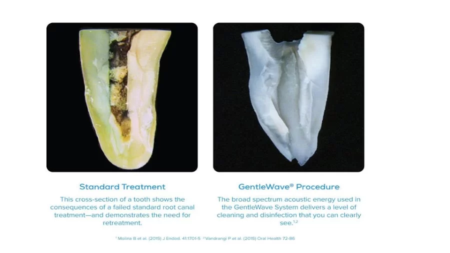 Bauman Endodontics Richard Bauman DMD Picture 2