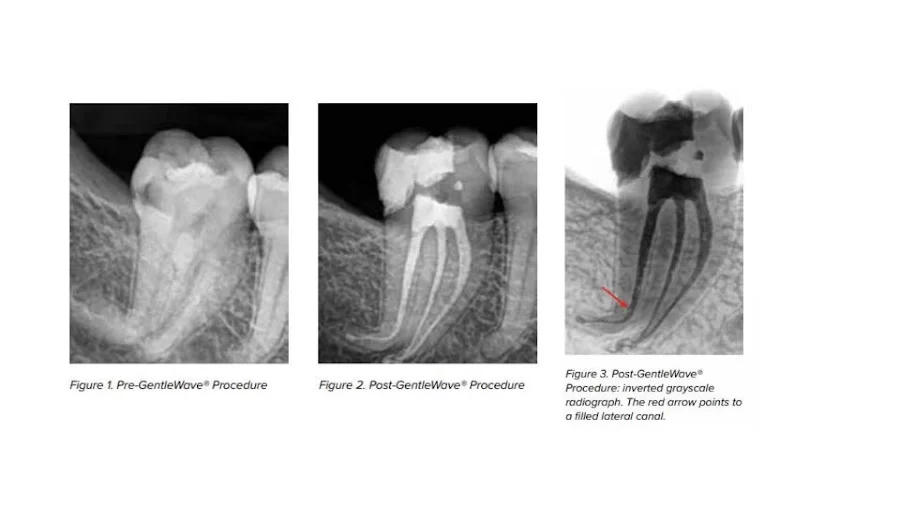 Bauman Endodontics Richard Bauman DMD Picture 1