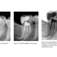 Bauman Endodontics Richard Bauman DMD ico