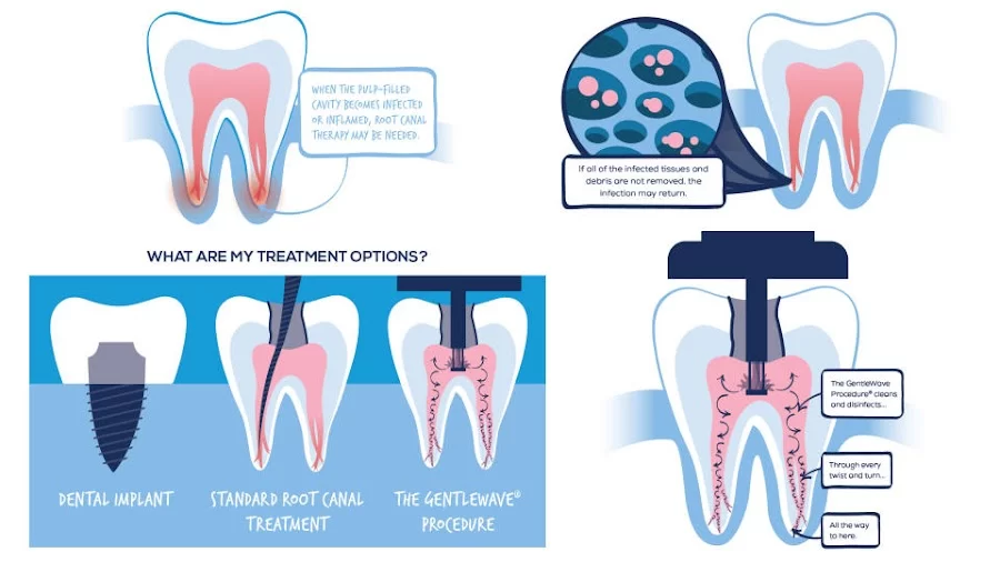 Bauman Endodontics Richard Bauman DMD Picture 3