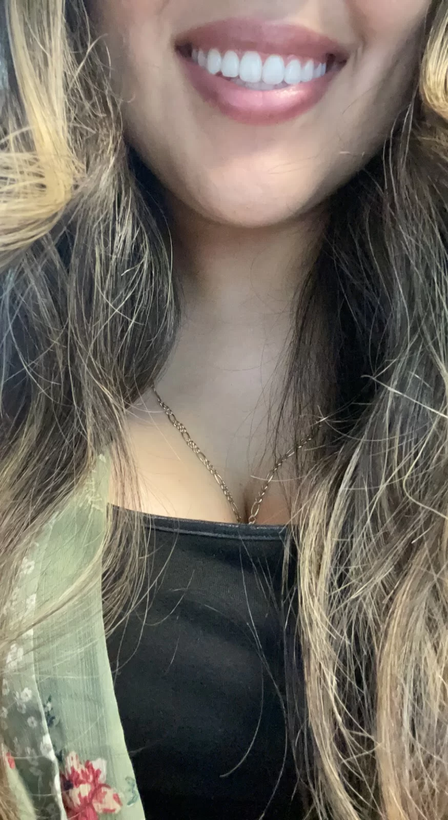 Granger Orthodontics Picture 8