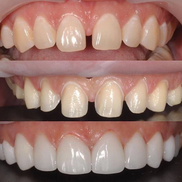 Redwood Dental Care Picture 6