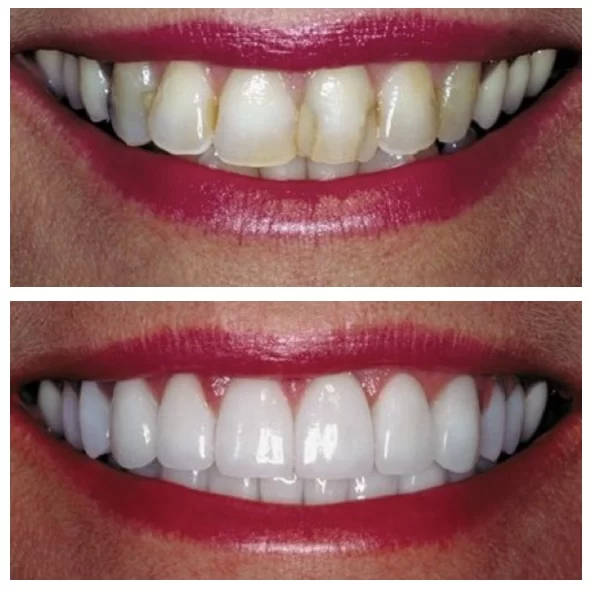 Redwood Dental Care Picture 4