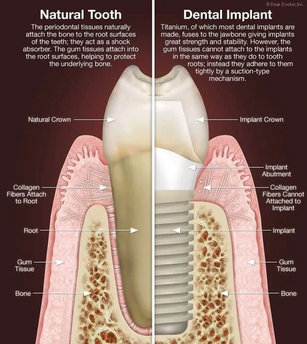 Redwood Dental Care Picture 7