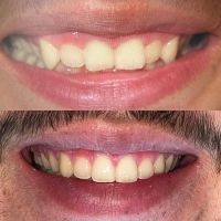 Holt Dental Care ico