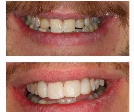 Pinecrest Dental: Dr. Tyler Williams - Biomimetic Dentistry & Implants