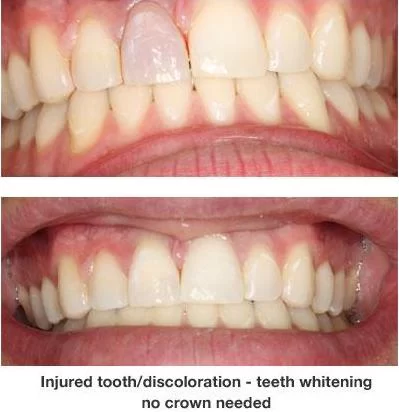 Pinecrest Dental: Dr. Tyler Williams - Biomimetic Dentistry & Implants Picture 4