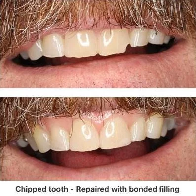 Pinecrest Dental: Dr. Tyler Williams - Biomimetic Dentistry & Implants Picture 5
