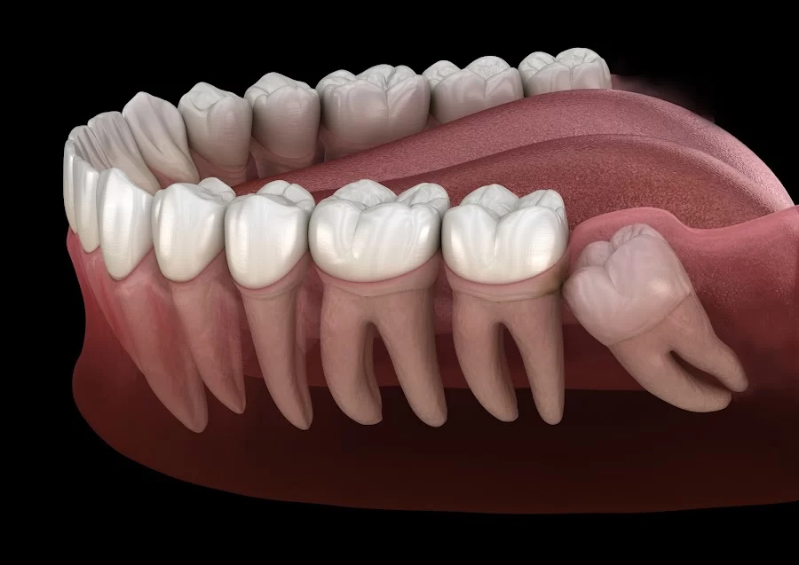 Southern Indiana Oral Surgery Picture 3