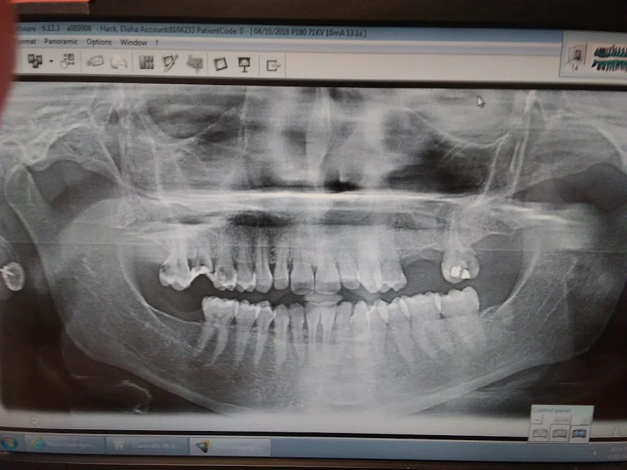 Aspen Dental - Clarksville, IN Picture 4