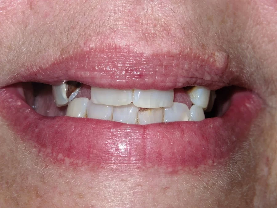 Affordable Dental Care Picture 5