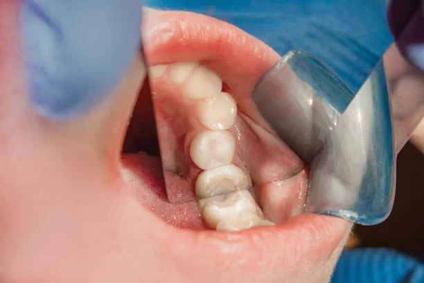 Family Dental of Fort Myers Picture 1