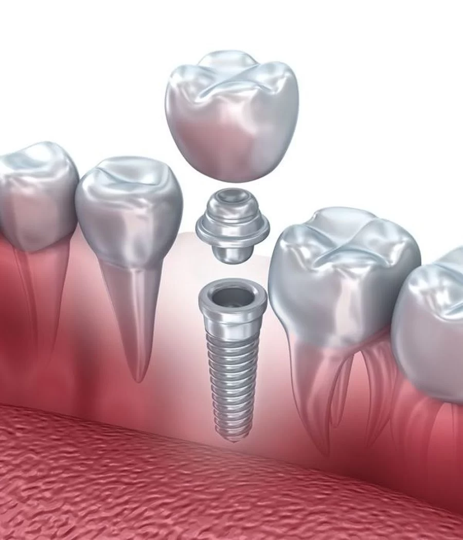 White Pine Dental Picture 2
