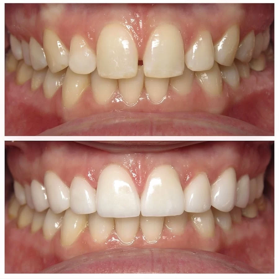 White Pine Dental Picture 6