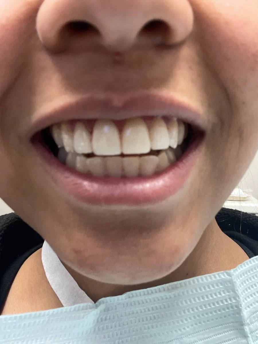 Absolute Dental - Aliante Picture 6