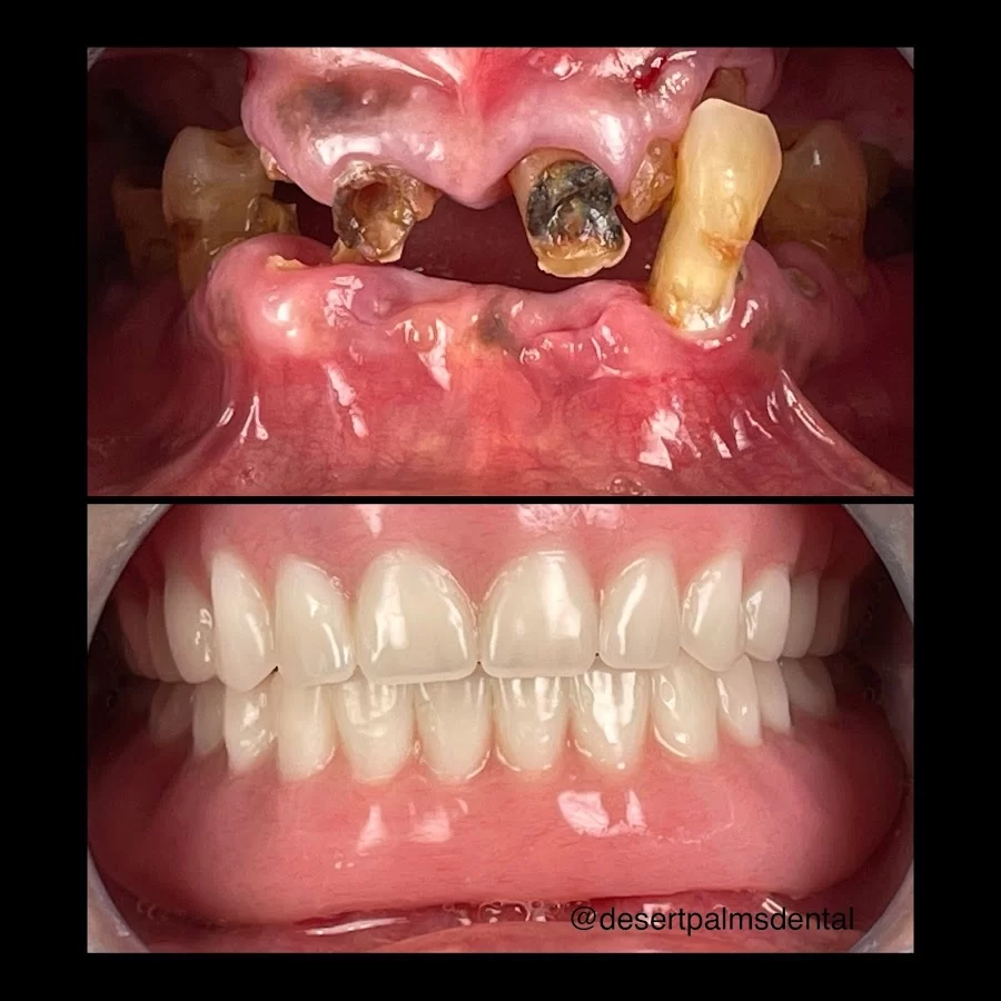 Desert Palms Dental Picture 8