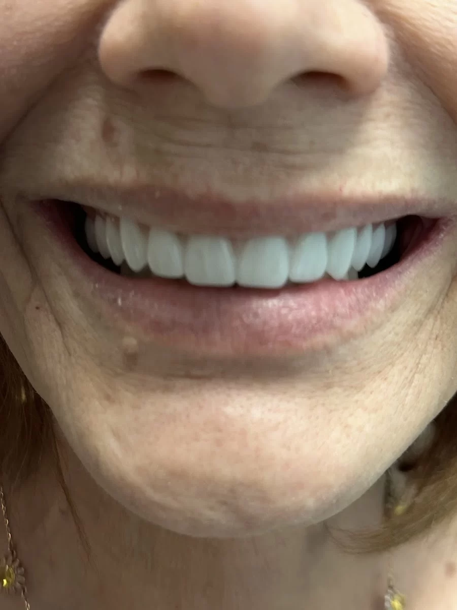 Desert Palms Dental Picture 9