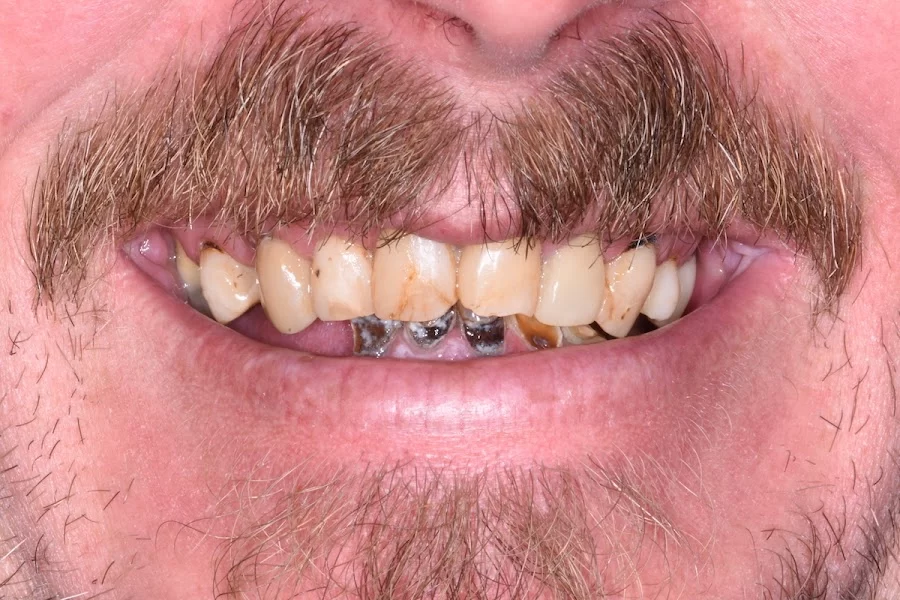Bird Dental Studio Picture 3