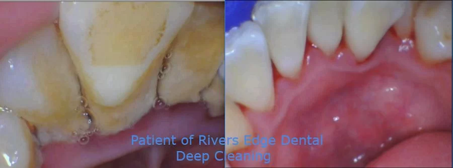 Rivers Edge Picture 3