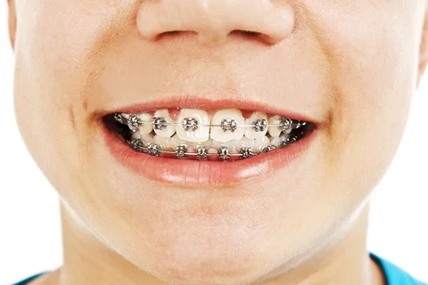 Element Dental & Orthodontics Bryan Picture 3