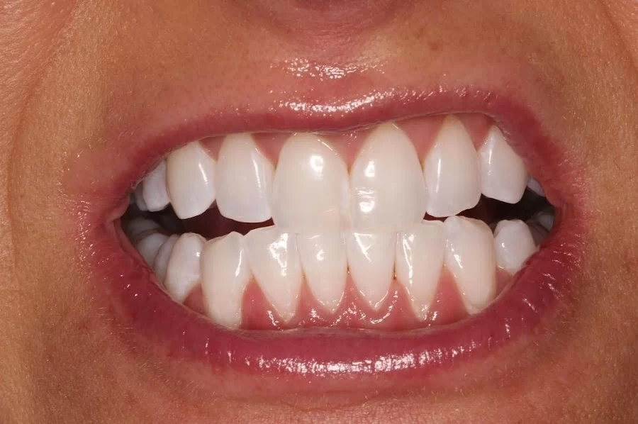 Southwest Vegas Smiles Picture 1