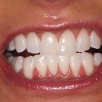 Southwest Vegas Smiles ico