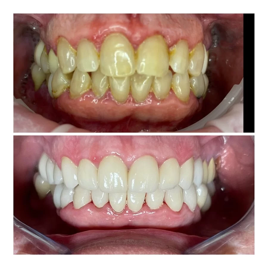 Woolf Dental: Dallas M. Woolf, DDS Picture 6