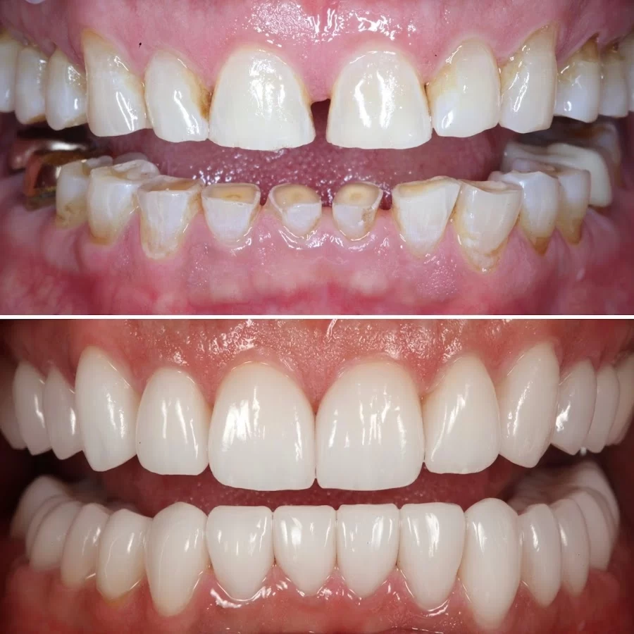 Woolf Dental: Dallas M. Woolf, DDS Picture 5