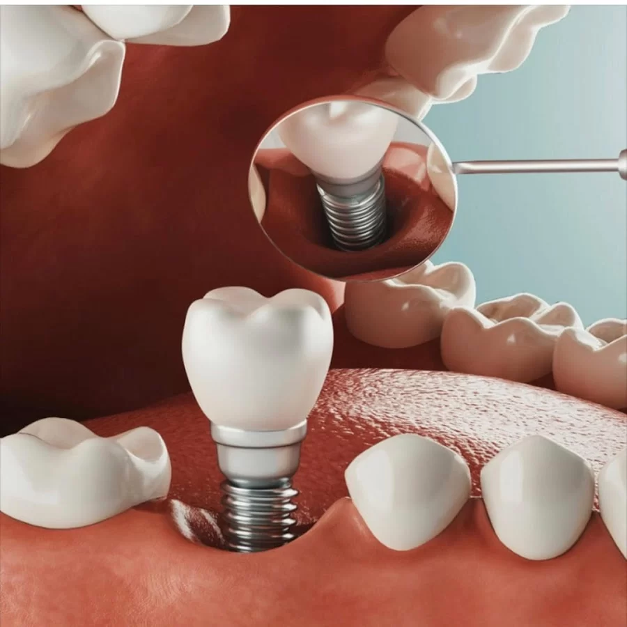 Vegas Dental Experts Picture 1