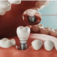 Vegas Dental Experts ico