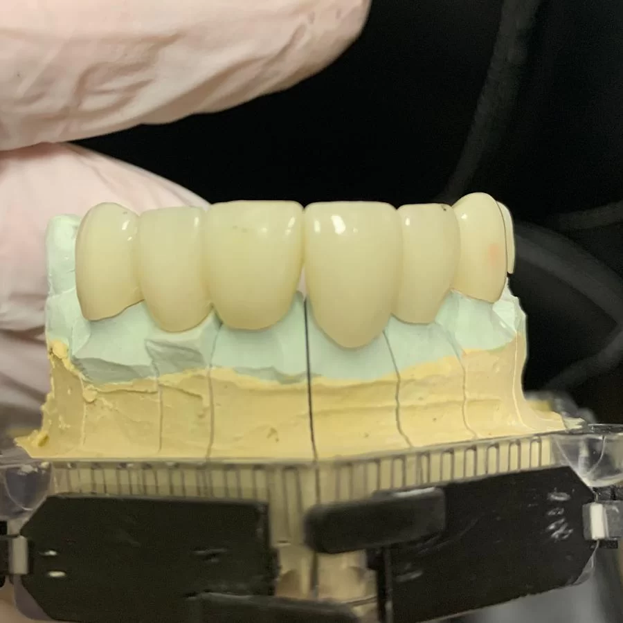 Accelerated Dental of Spring Valley Las Vegas Picture 9