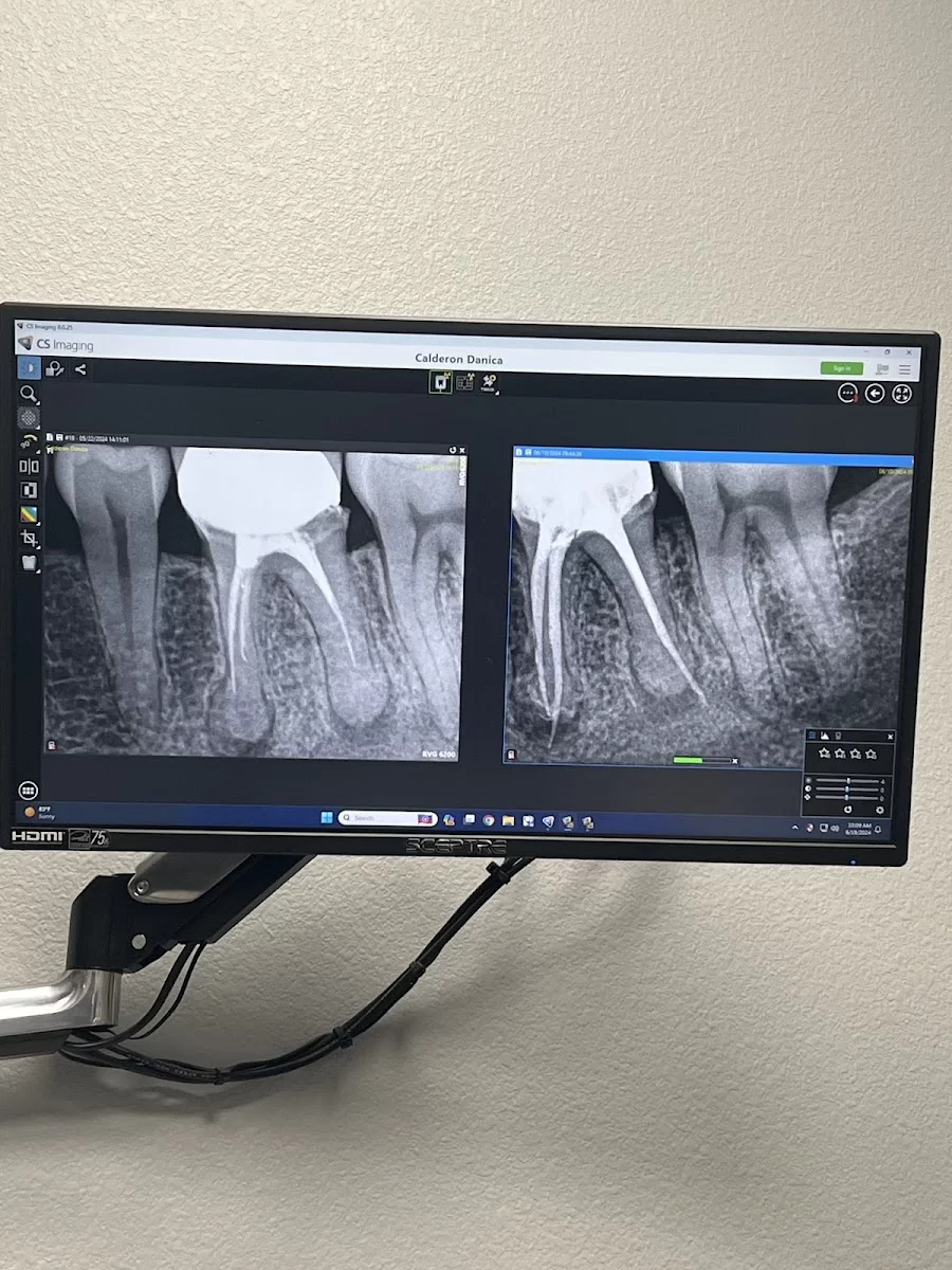 Apex Endodontics of Las Vegas Picture 6