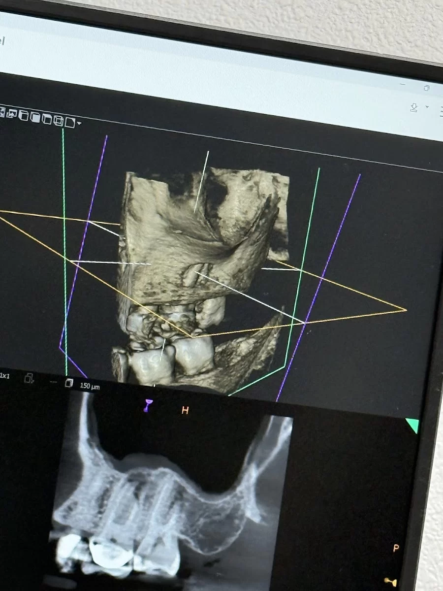 Apex Endodontics of Las Vegas Picture 5