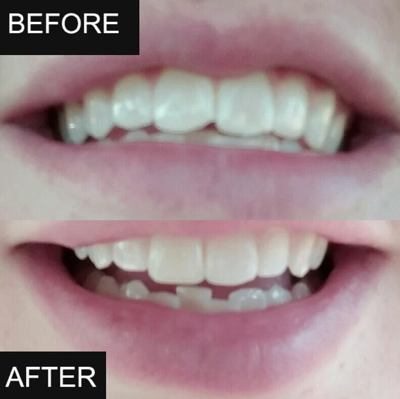 B. Kent Bladen, DDS Picture 8