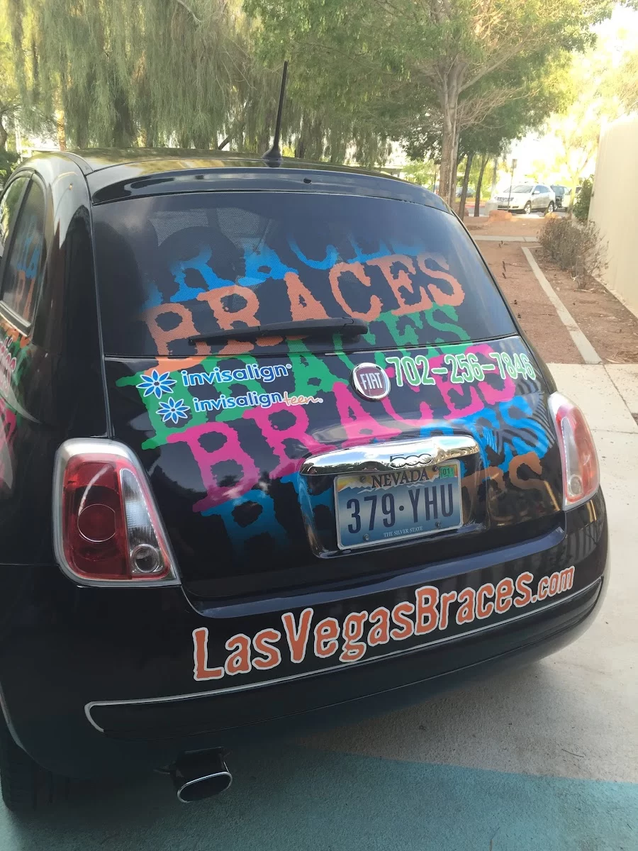 Las Vegas Braces Picture 9