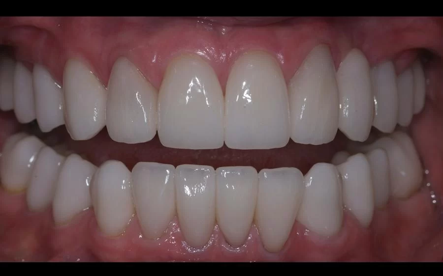 JB White, DDS | Cosmetic Dentist | Dental Implants Picture 7