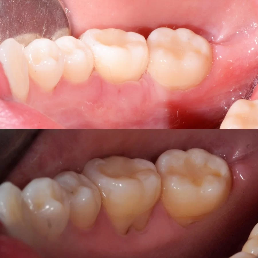Ed De Andrade : Anthem Periodontics and Dental Implants Picture 1