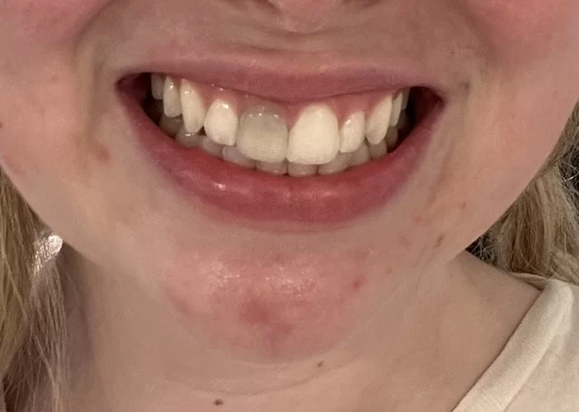 Belle Meade Endodontics Picture 7