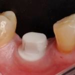 John G Masso DDS- Belcourt Family Dentistry PC