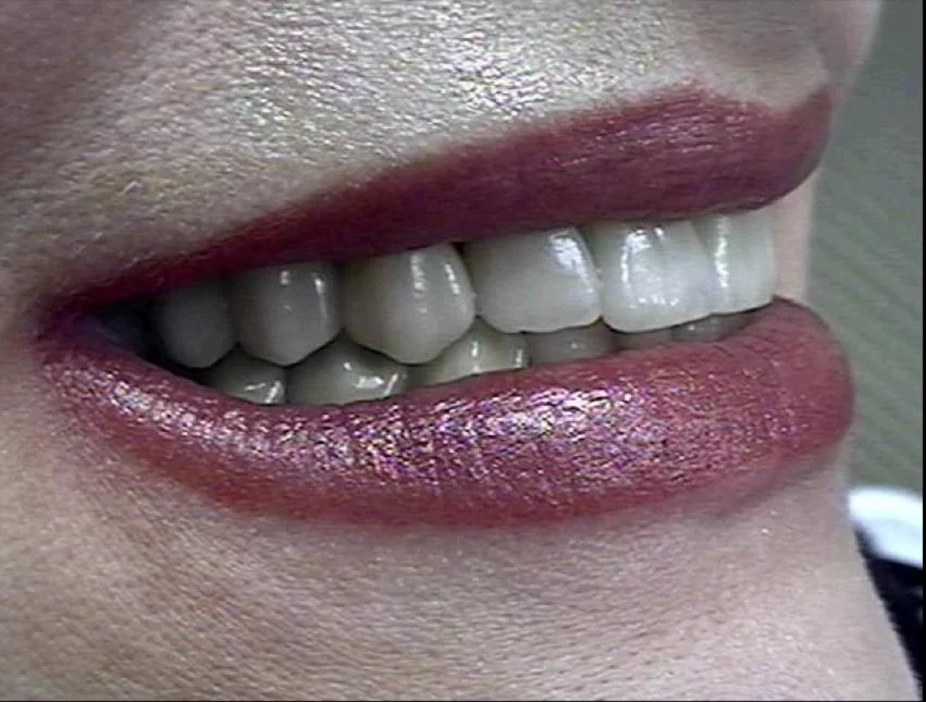 John G Masso DDS- Belcourt Family Dentistry PC Picture 10