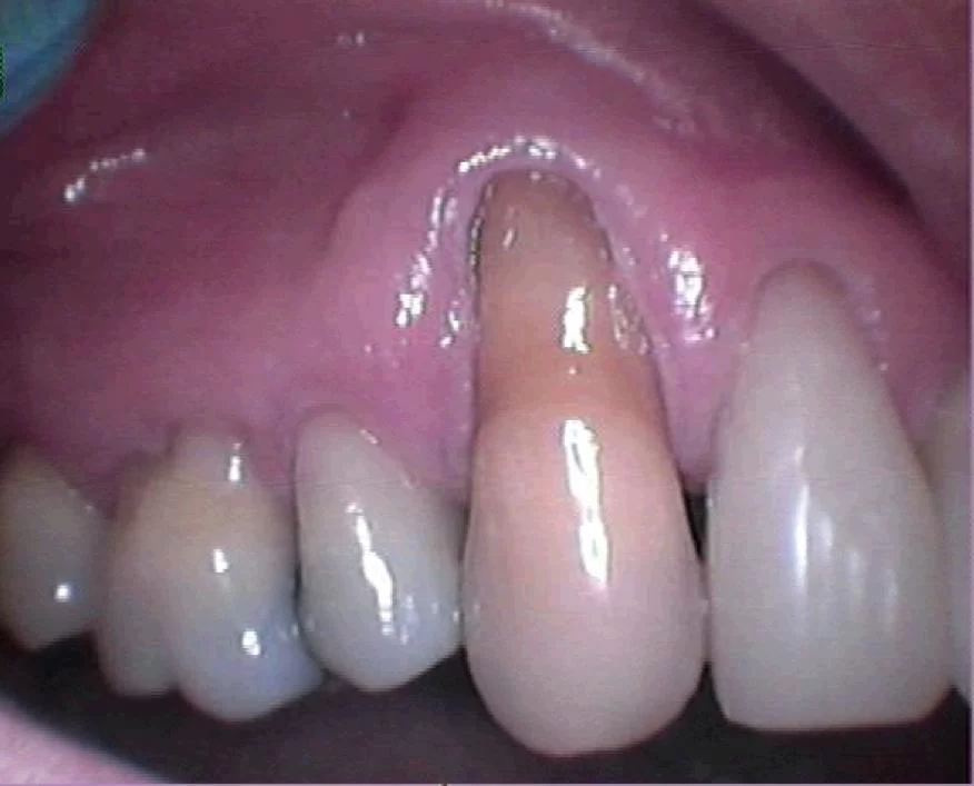 John G Masso DDS- Belcourt Family Dentistry PC Picture 8