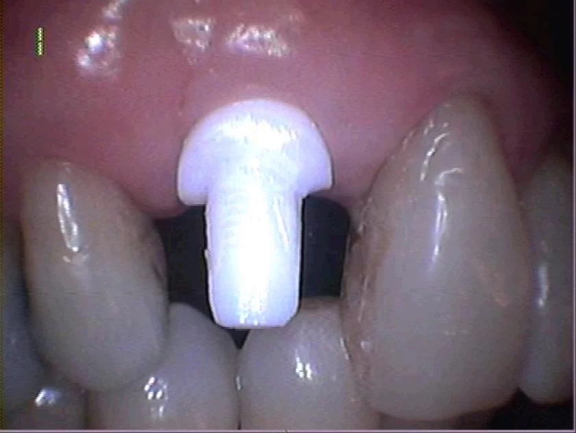John G Masso DDS- Belcourt Family Dentistry PC Picture 9