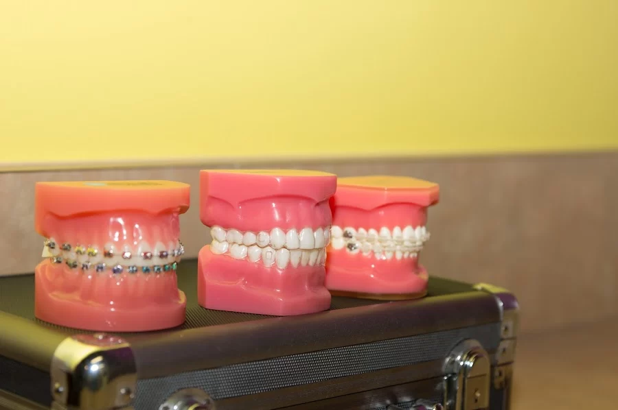 Braces By Dr. Ruth Picture 3
