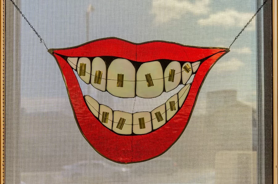 Braces By Dr. Ruth Picture 9