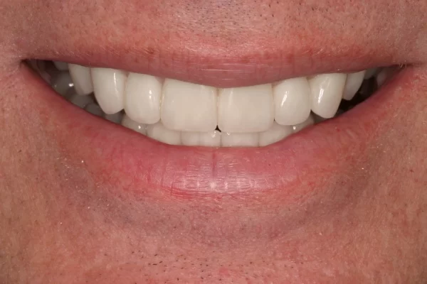 Green Dental Health and Aesthetics Picture 6